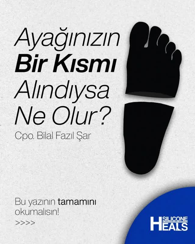 Ayağınızın bir kısmı alındıysa ne olur?